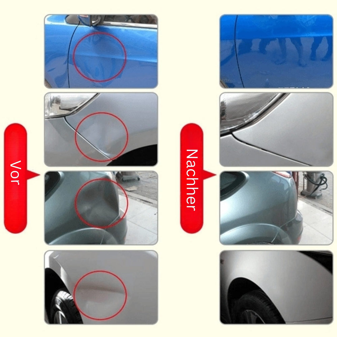 Redskab til fjernelse af buler | Fjern buler og skader fra bilen | DellenMeister